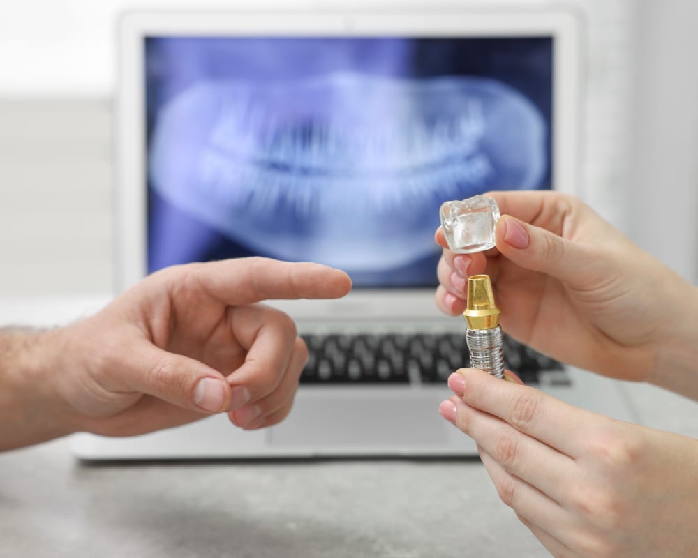 Dental Implants in King City | Dawson Dental