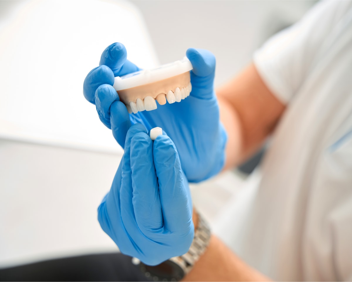 Dental Crowns